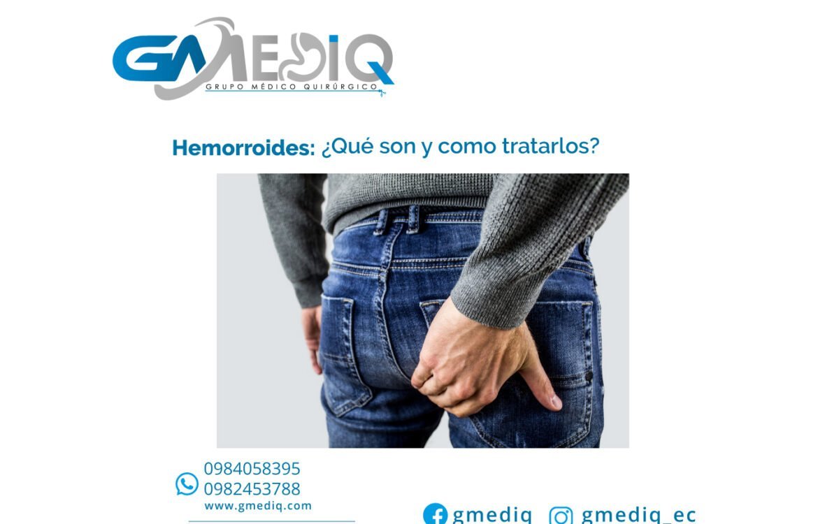 ¿QUÉ SON LAS HEMORROIDES Y CÓMO TRATARLAS?