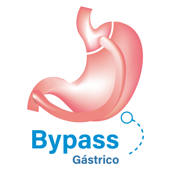 Bypass gástrico en Ecuador Quito los mejores especialistas