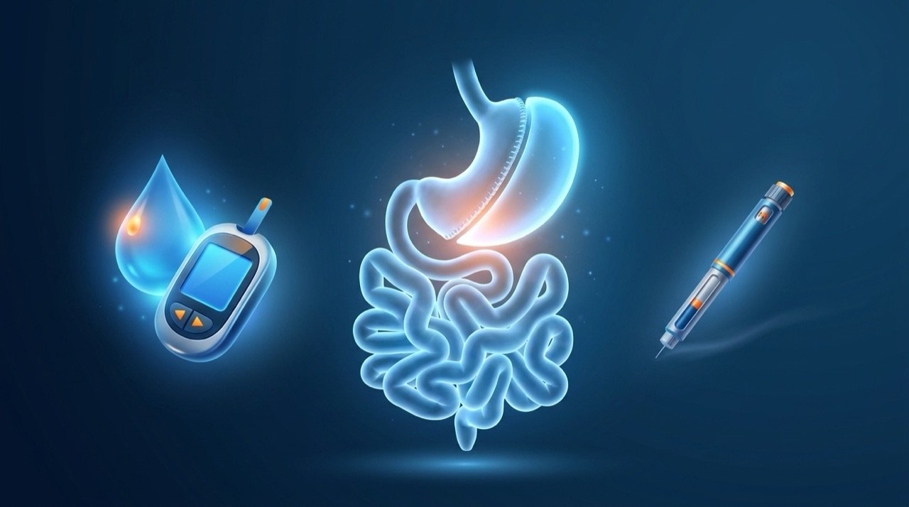 Cirugía bariátrica y diabetes tipo 2: ¿puede remitir?