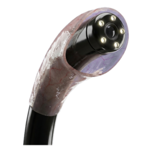 Ícono 3D endoscopia